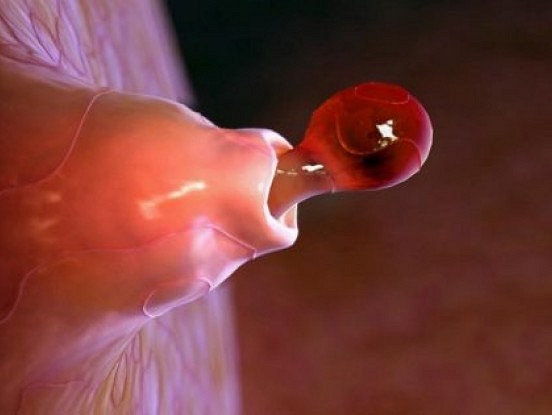 Lūk, ko nedrīkst darīt menstruāciju laikā! 9 bīstamas kļūdas, ko pieļauj gandrīz visas sievietes...