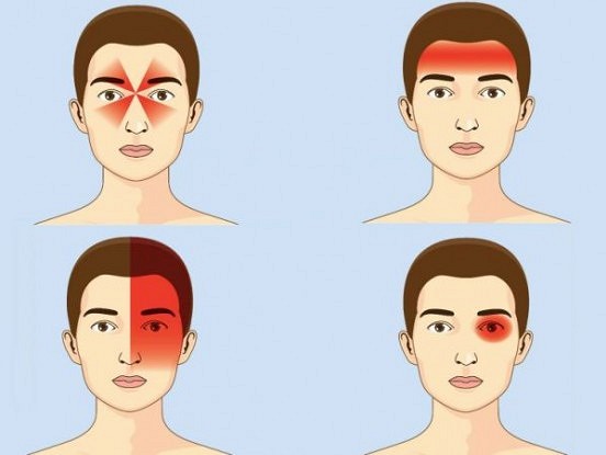 Ko galvassāpes tev pasaka par tavu vispārējo veselības stāvokli