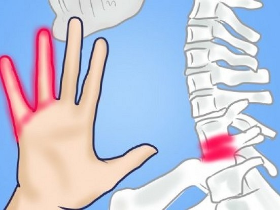 Kāpēc tirpst rokas? 7 iemesli, kuri liek aizdomāties par veselību