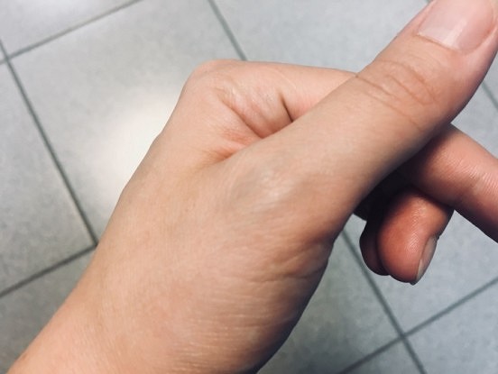 Izlasīju, ka visiem vīriešiem ir rēta uz kreisās rokas rādītājpirksta. Man arī tā ir. No kurienes?