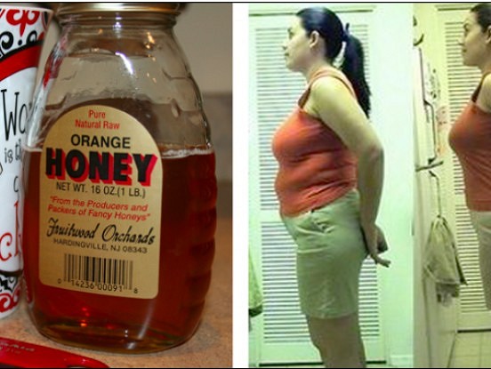 Medus un kanēlis- šīs divas sastāvdaļas  paveiks brīnumus ar jūsu vidukli!