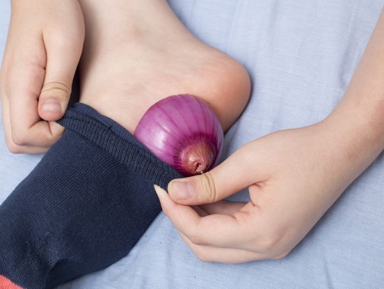 Sīpols pie pēdas un aizmirsti par ļoti nepatīkamu problēmu